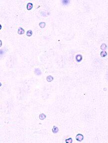 Urine 2 cas 8