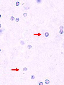 h�mat_l�gfl.jpg (8480 octets)