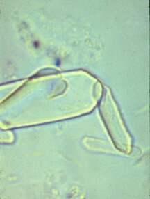 Urine 1 cas 8