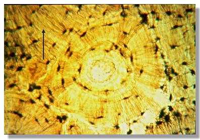 toss22p.jpg (21004 octets)