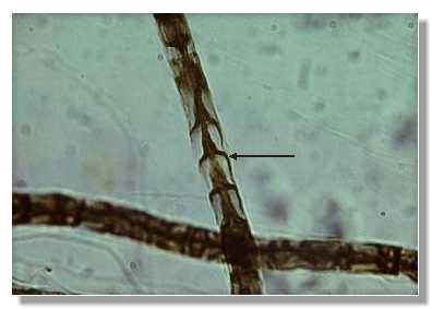 tnerv8p.jpg (10373 octets)
